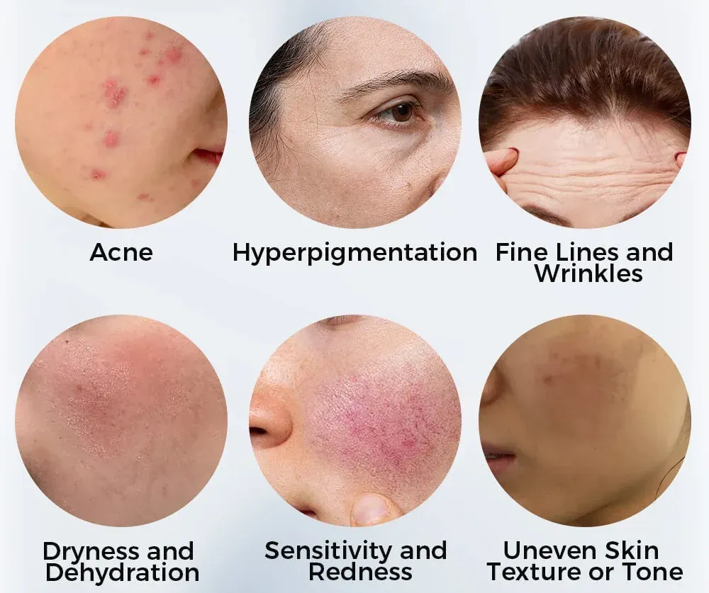 Skin Analysis treatment at Pure Glow Aesthetics, Birmingham